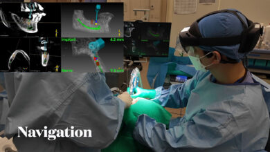 A4Lab XAVE Mini: Making High-Precision Surgical Navigation Affordable